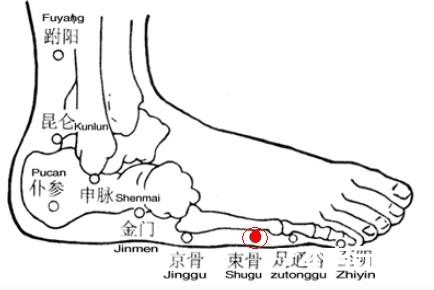 用落枕穴治疗落枕（悬钟穴、后溪穴、束骨穴、承山穴）