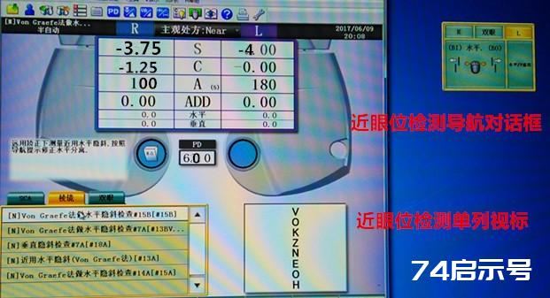 全自动综合验光仪检测操作图例详解  第17张