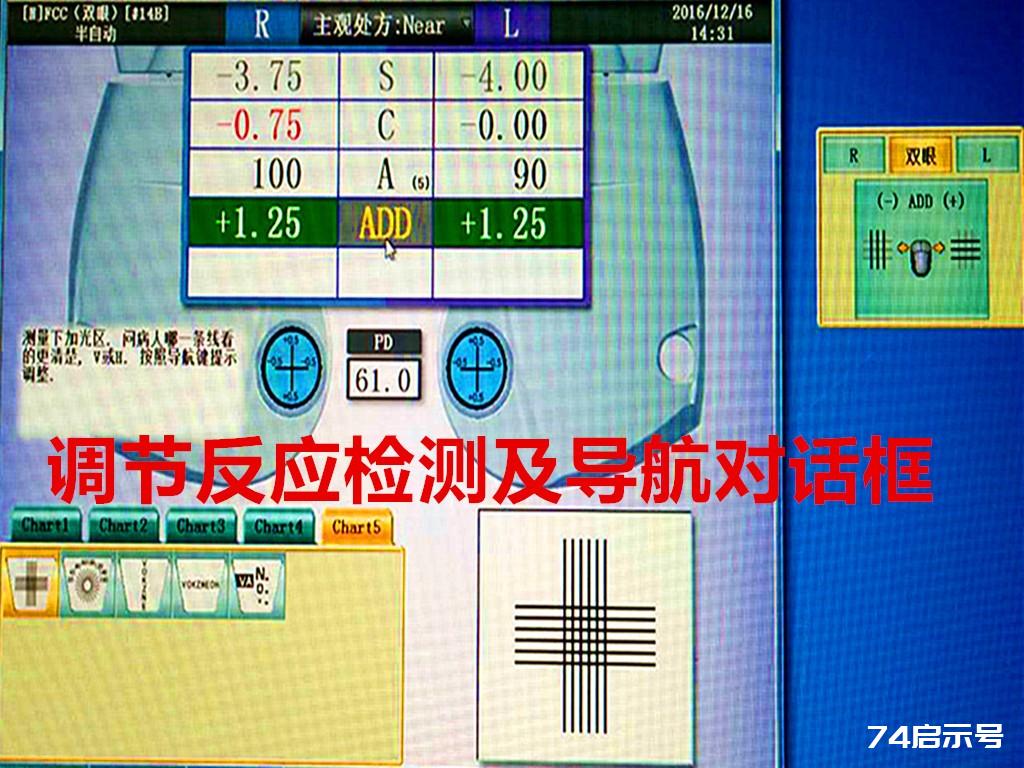 全自动综合验光仪检测操作图例详解  第24张