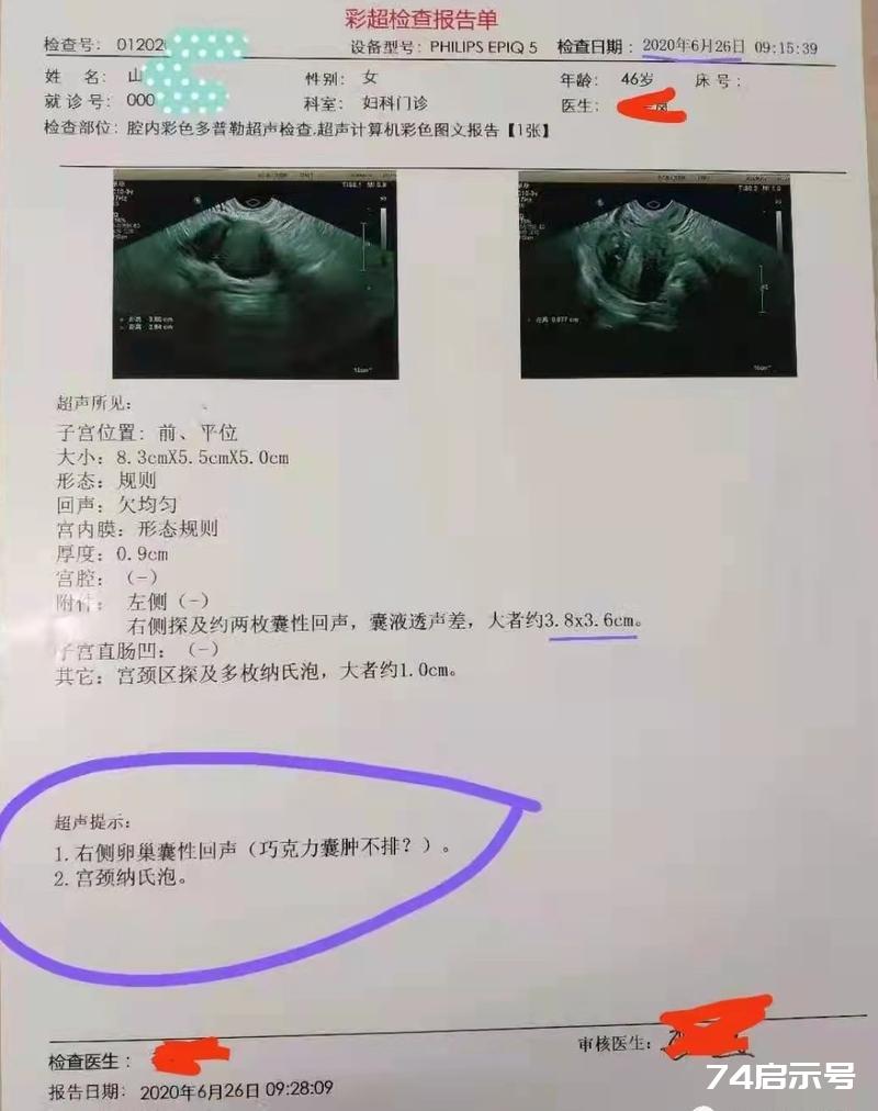 周炳昆用经方治子宫肌瘤案