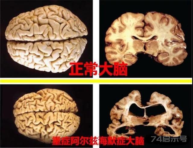 人类为何不能实现“永生”？科学家：人类只是在给基因打工罢了