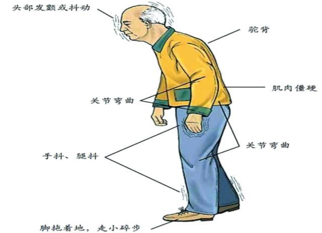 人类为何无法实现“永生”？生物学家：我们都是基因的“打工仔”