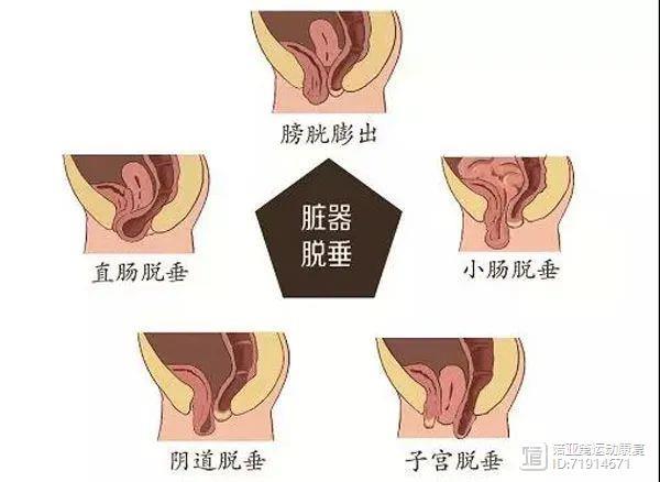 盆底肌和内收肌的关系