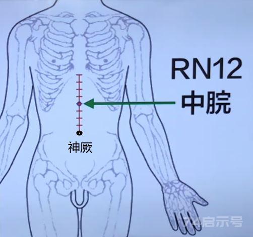 脑外伤后遗症（脑震荡）气滞痰瘀型取穴法