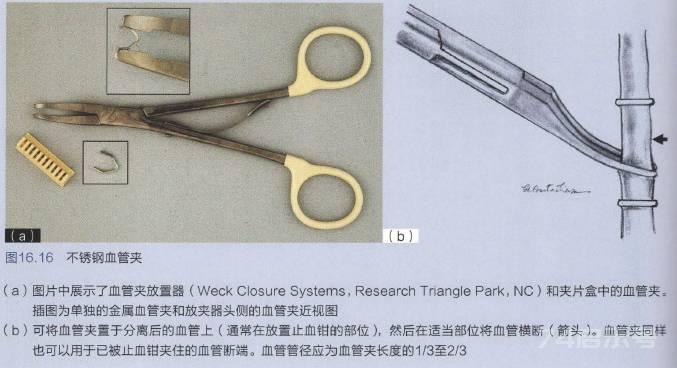 【今日读书】看完这篇，外科止血方法你就基本见全了