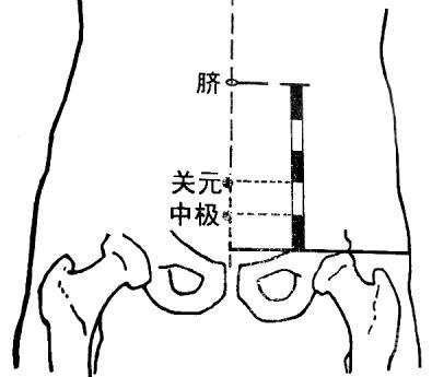 【中医秘方】 肉桂配丁香治好俺的前列腺炎