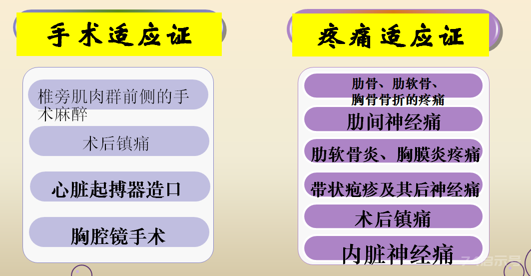 实用超声引导胸壁神经阻滞