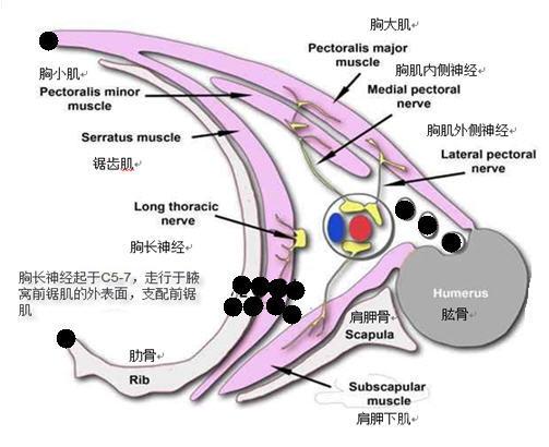 实用超声引导胸壁神经阻滞