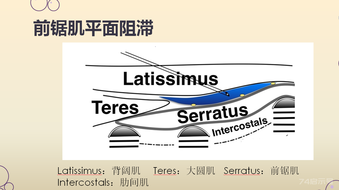 实用超声引导胸壁神经阻滞