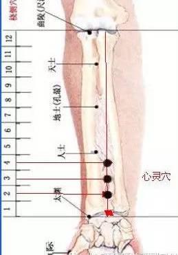 董氏奇穴之董氏针灸七十二绝（图谱）~