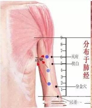 董氏奇穴之董氏针灸七十二绝（图谱）~