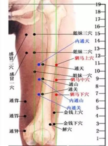 董氏奇穴之董氏针灸七十二绝（图谱）~