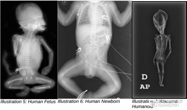 智利沙漠微型外星人遗骸，2018年谜团解开：竟与人类DNA突变有关