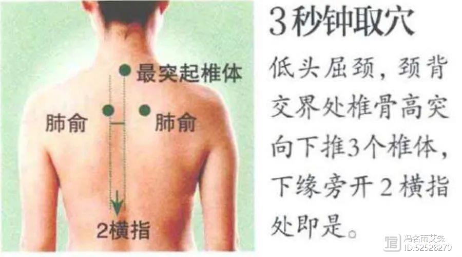 了解体内水液循环，穴位艾灸，解决下肢水肿