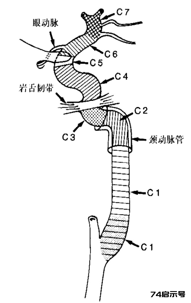 脑血管解剖学习笔记第27期：颈内动脉分段方法