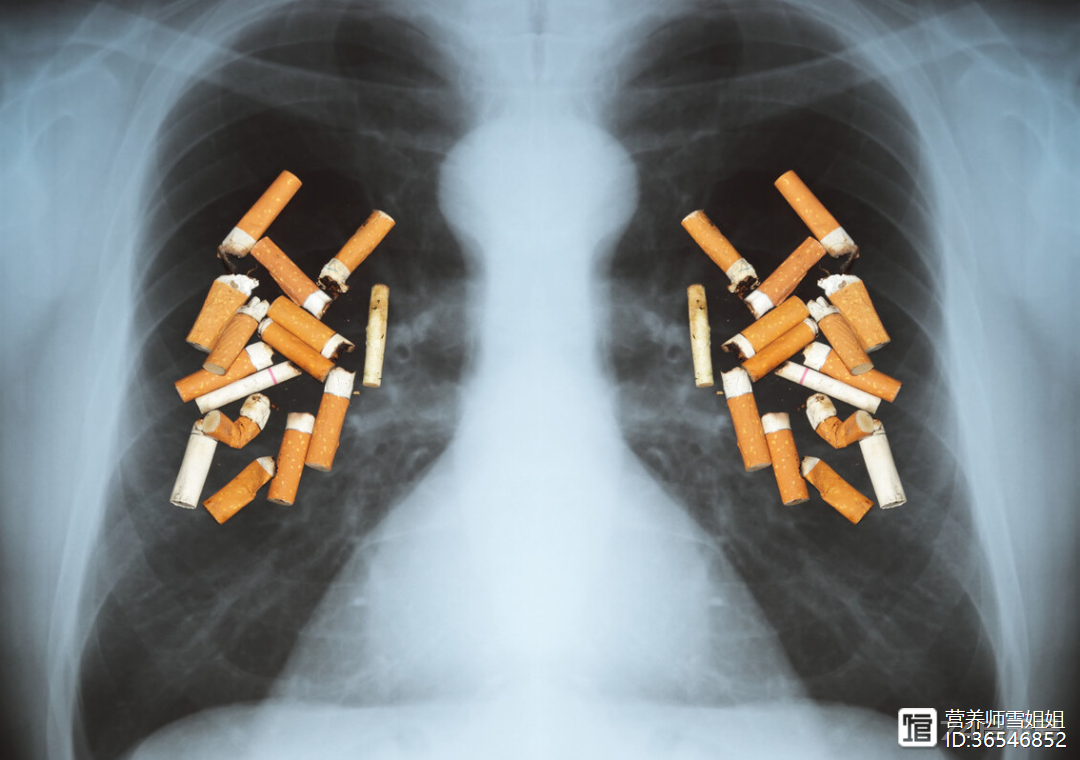 吸烟者，出现“1大、2痛”，小心肺癌，及时查CT，切莫拖延