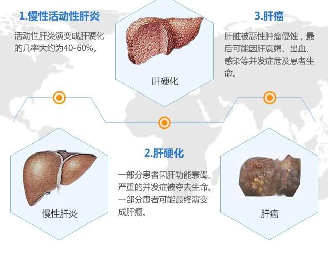 肝出血_肝出血是什么引起的_肝出血怎么办